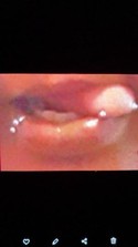 Reviews about escort with phone number 5854432564
